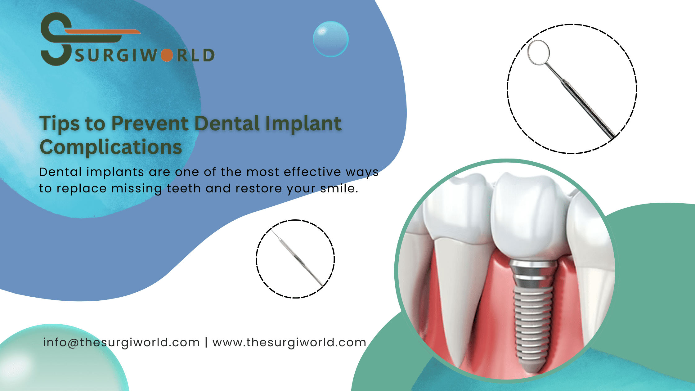 Dental Implant Complications