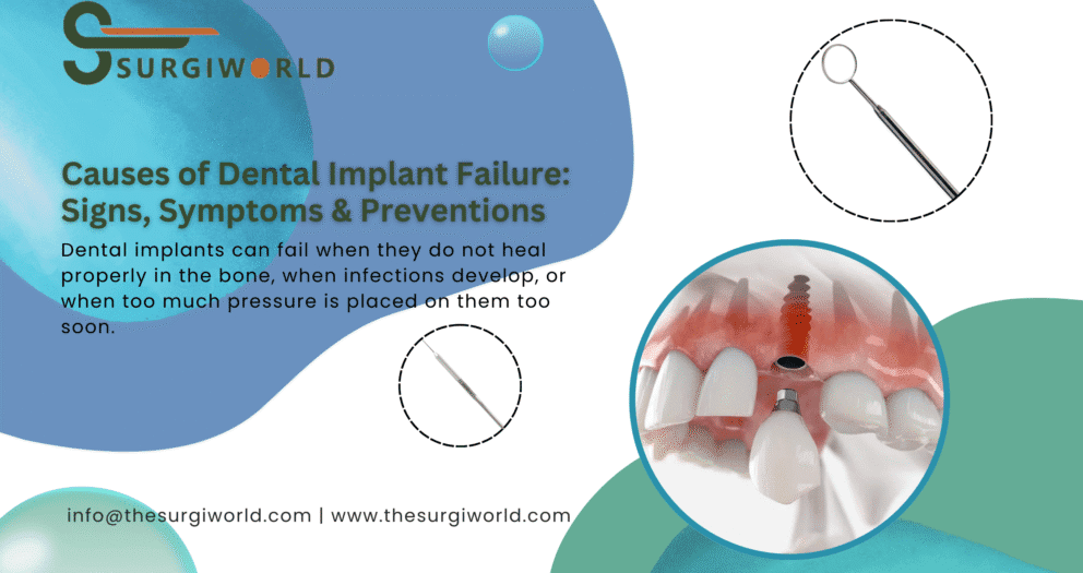 Causes of Dental Implant Failure: Signs, Symptoms & Preventions
